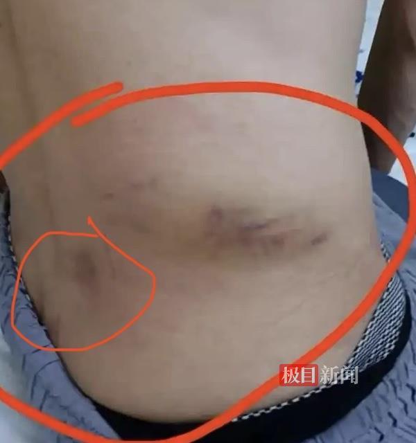  高危体育项目安全标准深度解析：景区蹦极事故背后的技术漏洞与责任边界 新闻 高危体育项目安全标准深度解析：景区蹦极事故背后的技术漏洞与责任边界 新闻 高危体育项目安全标准深度解析：景区蹦极事故背后的技术漏洞与责任边界 新闻 高危体育项目安全标准深度解析：景区蹦极事故背后的技术漏洞与责任边界 新闻